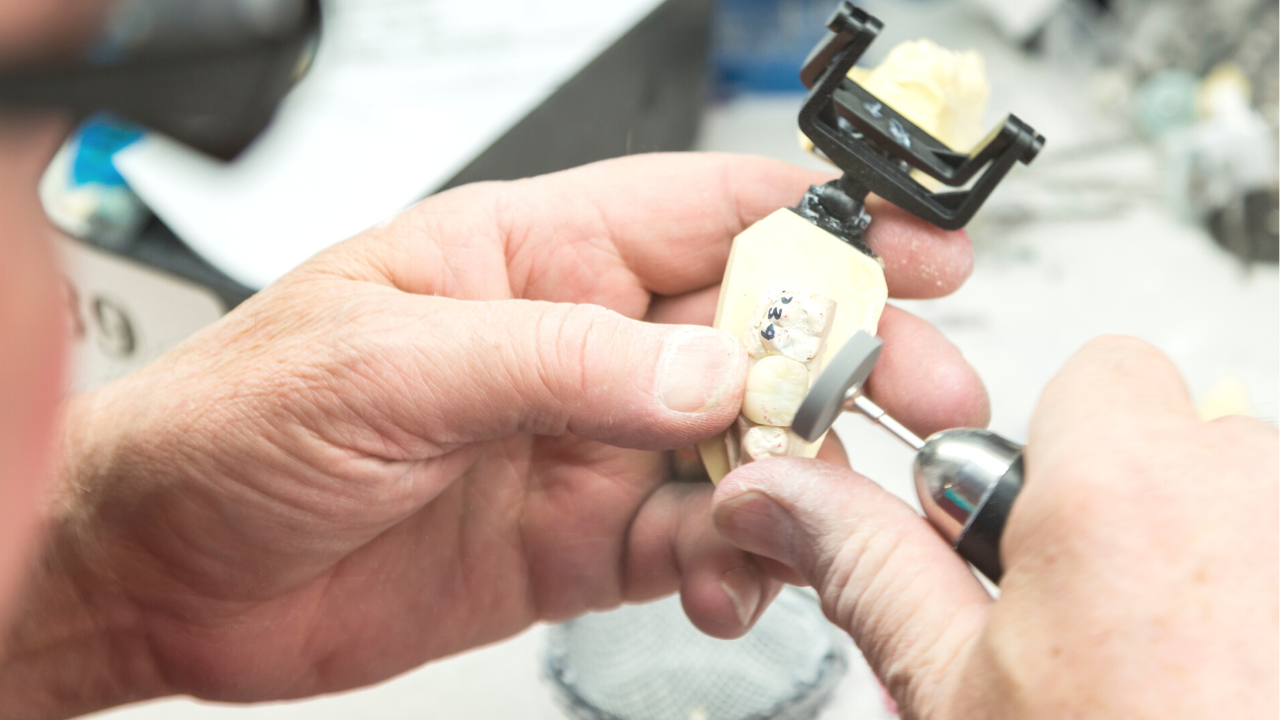 What is your standard turnaround time for a dental lab case?
